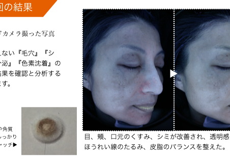 プリスティン ダイヤモンドコース(ご新規様限定) 5F MUSELLE BEAUTY