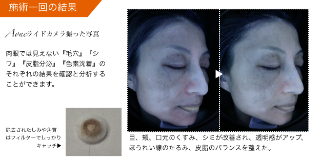 プリスティン ダイヤモンドコース(ご新規様限定) 5F MUSELLE BEAUTY